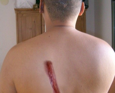 Un joven denuncia que sufrió una "brutal paliza" en Arrecife por parte de "una banda latina"