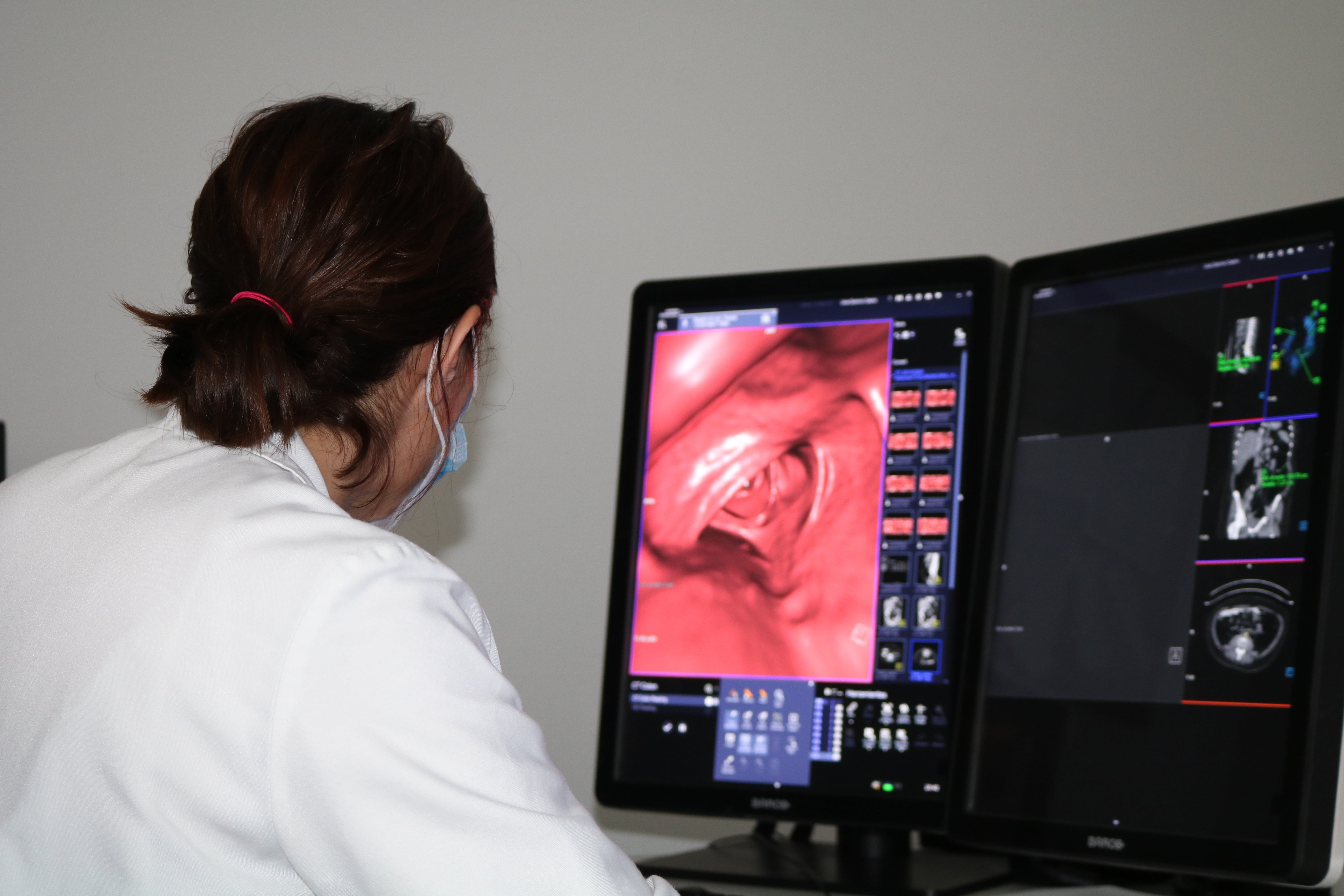 El Hospital Molina Orosa incorpora la colonoscopia virtual al servicio de Radiología