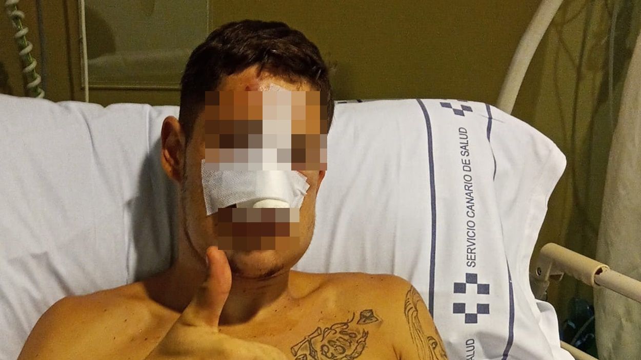 El joven de 17 años agredido, tras ser operado en el Hospital Doctor Negrín