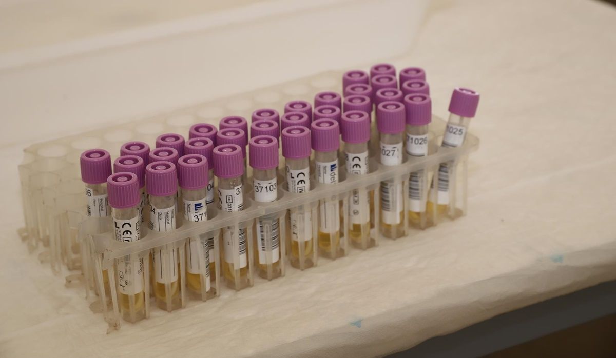 Muestras para PCR realizadas en el autocovid