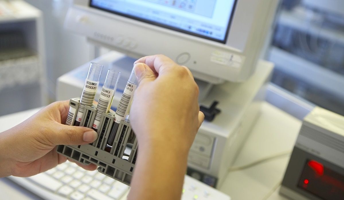 Muestras de sangre para el diagnóstico de la viruela del mono Muestras de sangre para el diagnóstico de la viruela del mono