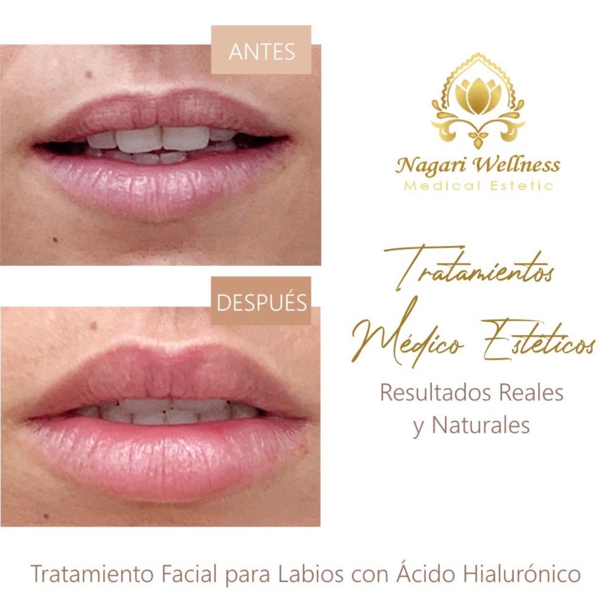 Nagari Wellness Medical Estetic, un novedoso concepto de Clínica & Boutique Nagari Wellness Medical Estetic, un novedoso concepto de Clínica & Boutique