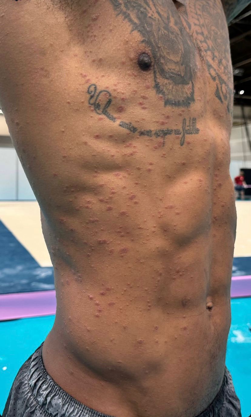 Las imágenes publicadas por el gimnasta en sus redes sociales. Foto: Rayderler Zapata. Las imágenes publicadas por el gimnasta en sus redes sociales. Foto: Rayderler Zapata.