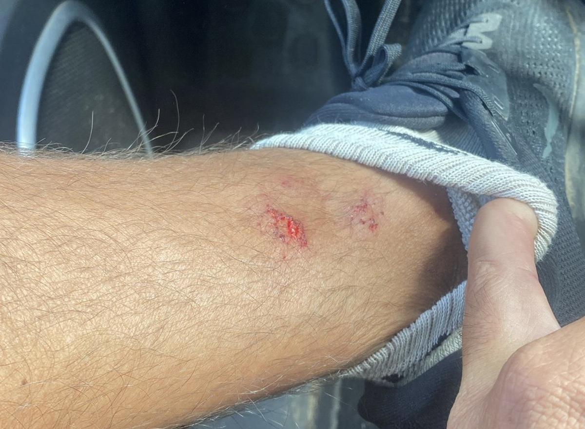 Una de las heridas ocasionadas por la presunta agresión