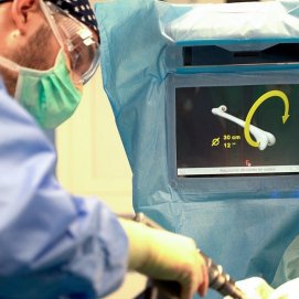 Instante de una cirugía en la que se usa la nueva tecnología