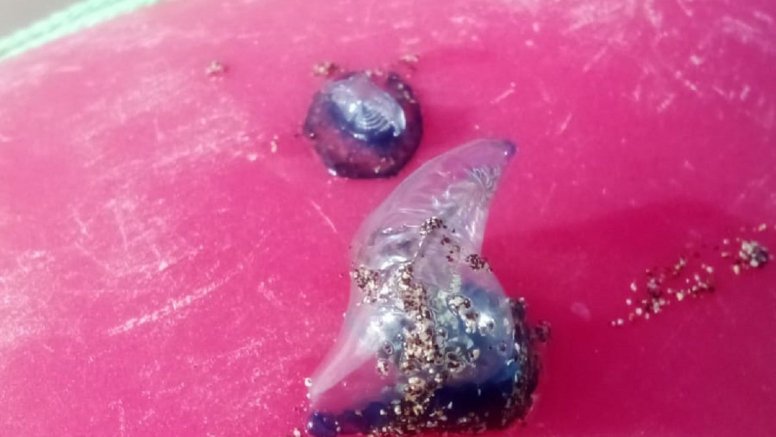 Medusas en la playa de La Garita