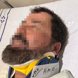 El hombre atropellado por su hermano