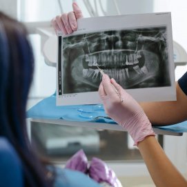 Una persona en una consulta del dentista. Foto: Cottonbro Studio.