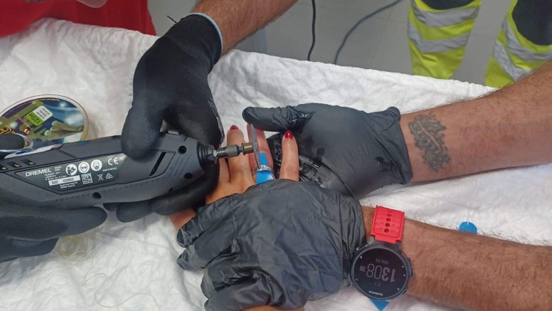 Los bomberos sacan un anillo atascado en un dedo a una mujer en Playa Blanca 
