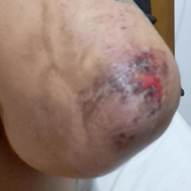 Una de las heridas fruto de la paliza