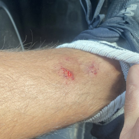 Una de las heridas ocasionadas por la presunta agresión