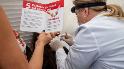 Dentistas de la provincia realizan revisiones gratuitas de la mucosa oral