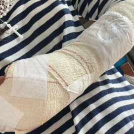 Consecuencias de la presunta agresión en La Graciosa