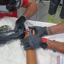 Los bomberos sacan un anillo atascado en un dedo a una mujer en Playa Blanca 