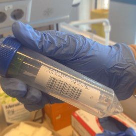 Imagen de una prueba PCR de Covid